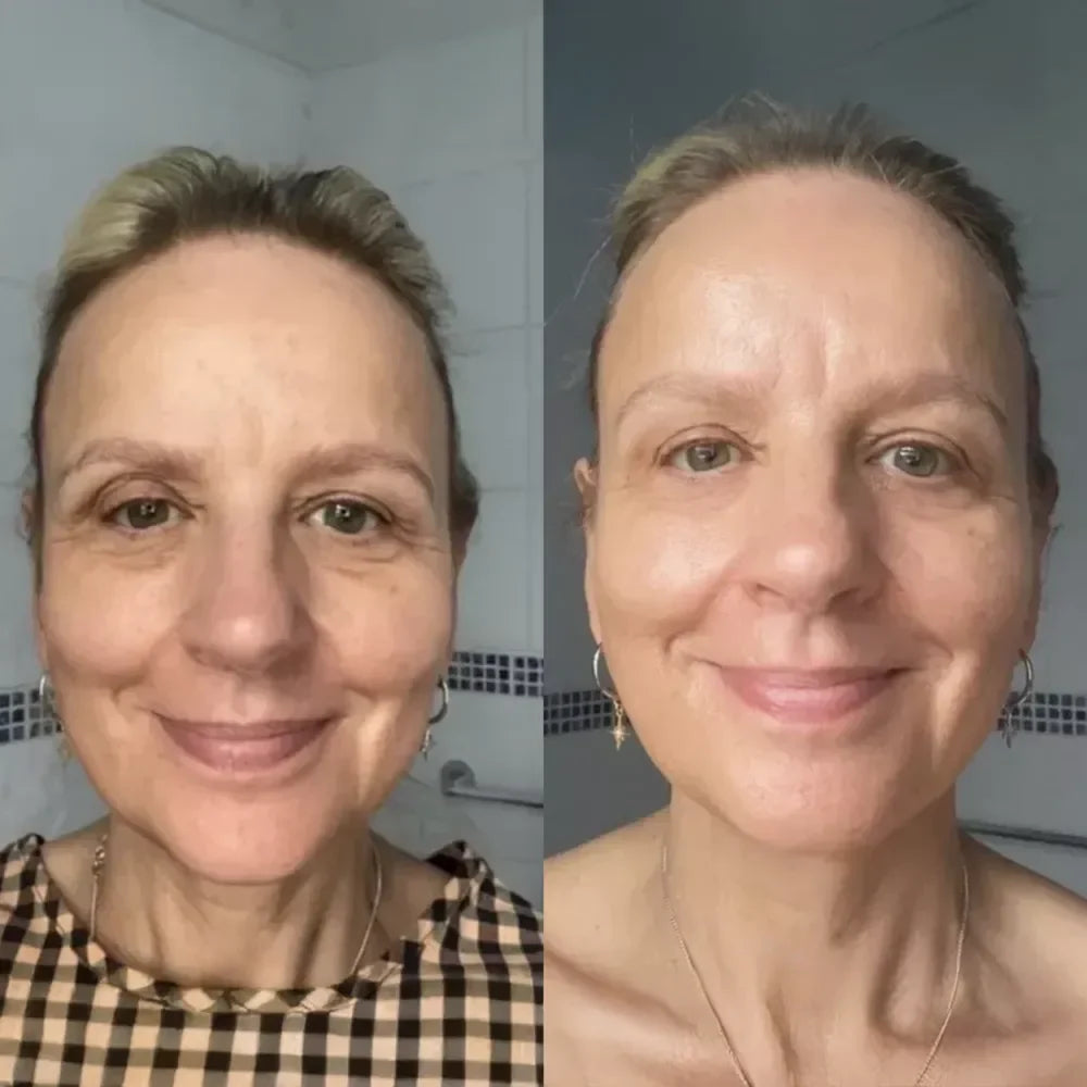 Brosse Lymphatique Visage